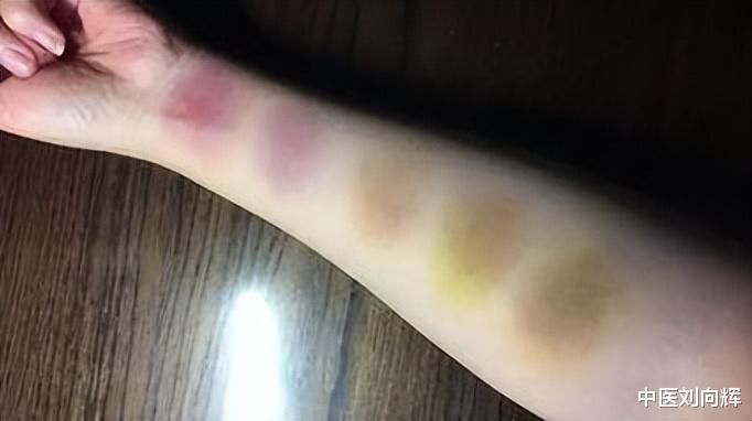 陈皮|虚、寒、湿、瘀、堵，5个阶段你在哪个？ 分享一方，帮你走出循环