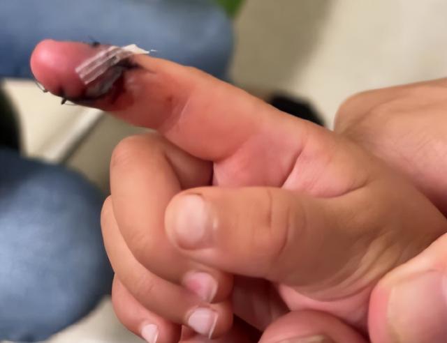 郑爽|代孕女儿手指割伤,儿子疑似烫伤,爽爸撕张恒,粉丝却夸郑爽温柔