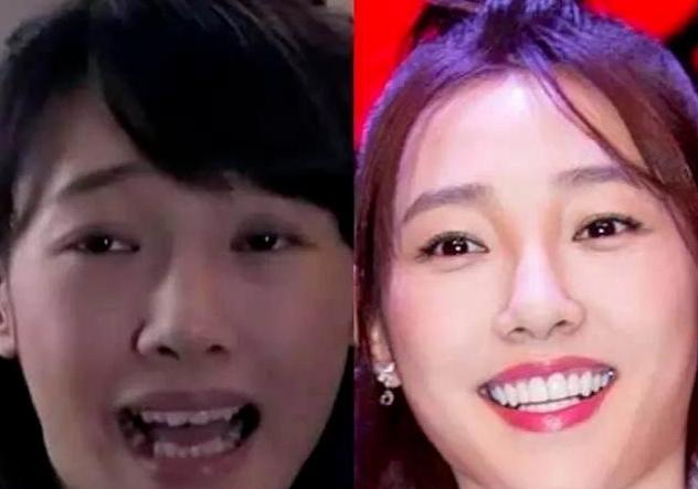 明星 明星常用好物：黄晓明的发套，鞠婧祎的肩垫，还有薛之谦的鞋垫