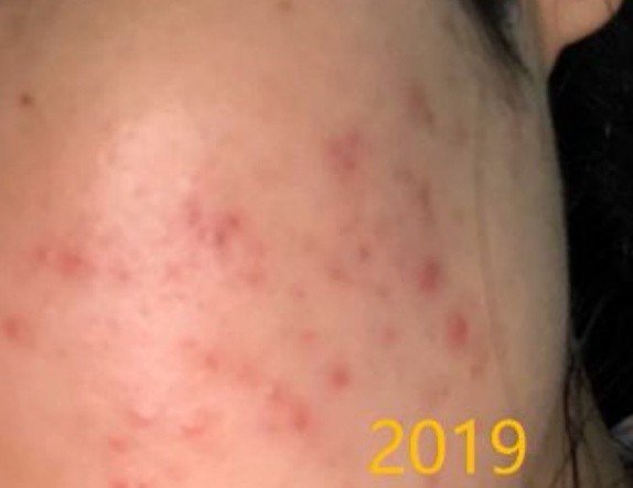 护肤品|掏家底式孕期护肤品分享！亲测5款史上良心护肤品，安全不踩雷