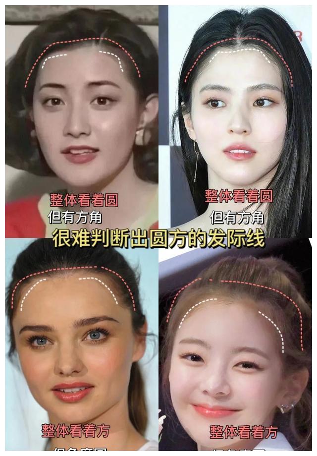 发际线|朴敏英新剧《月水金火木土》,这个发际线好像戴了个假头套?