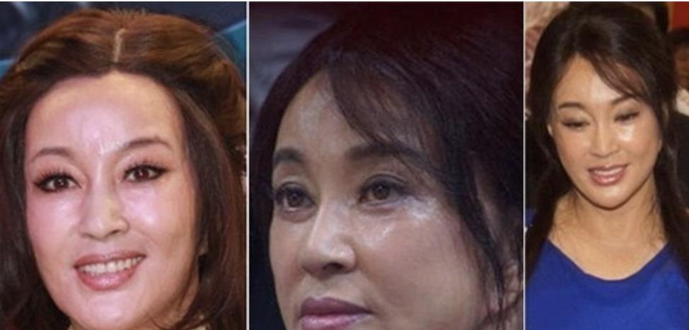 伊能静 强行扮嫩、动脸成瘾、为减肥切胃洗肠，女星的畸形审美好恐怖