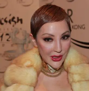 整容|脸肿成发面团，下巴能犁地？中老年女星整容后遗症才是“重灾区”