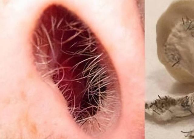 疾病|鼻毛外窜的男人，有何不同之处？鼻毛变白说明了什么？涨知识了