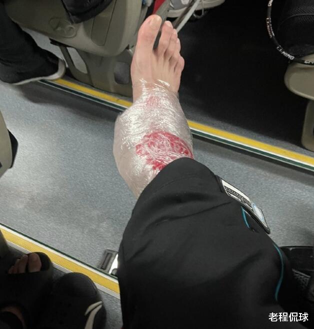 郭艾伦|郭艾伦回应被垫脚，防投篮应收脚保护对手，都是朋友盼以后多注意