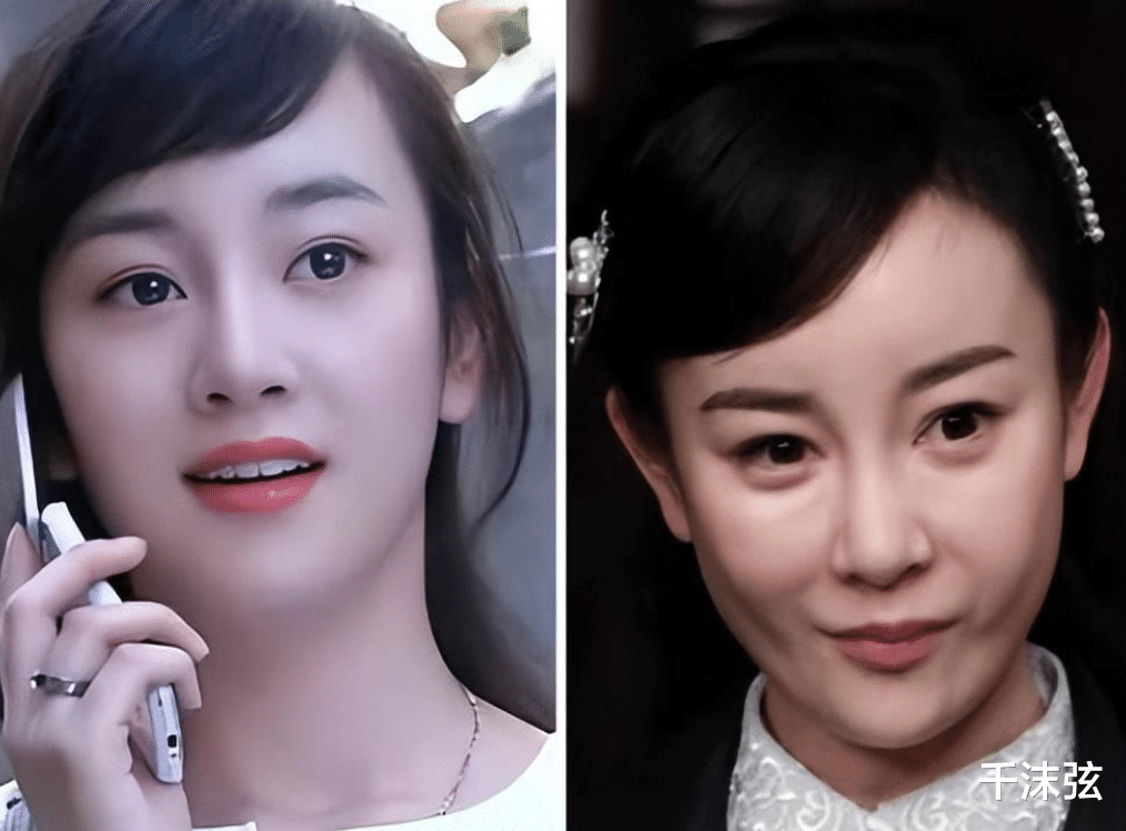 整容|55岁张蔷自曝整容失败！素颜怼脸大方展示疤痕，吐槽医生不认真