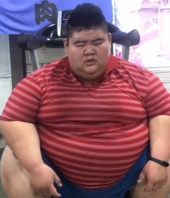 |作为“中国第一胖”的王浩楠体重出现了反弹，肚皮变成三层，被网友嘲像“千层饼”