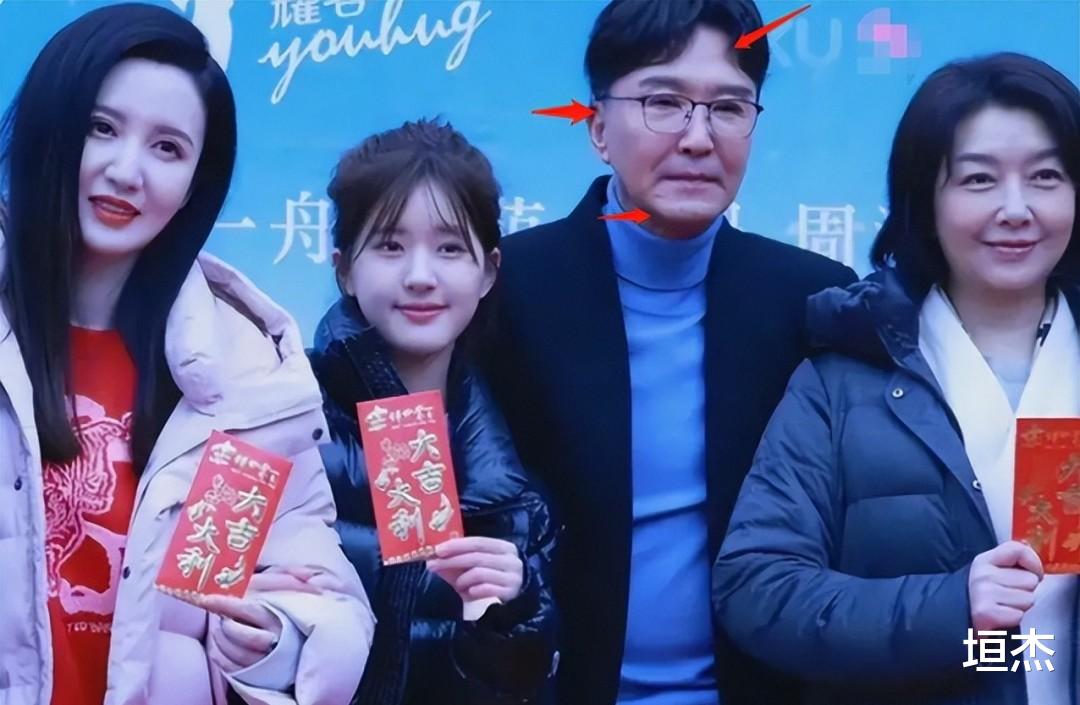 男神|脸部变形、发腮油腻、整容成瘾,细数8位男神的颜值暴跌之路