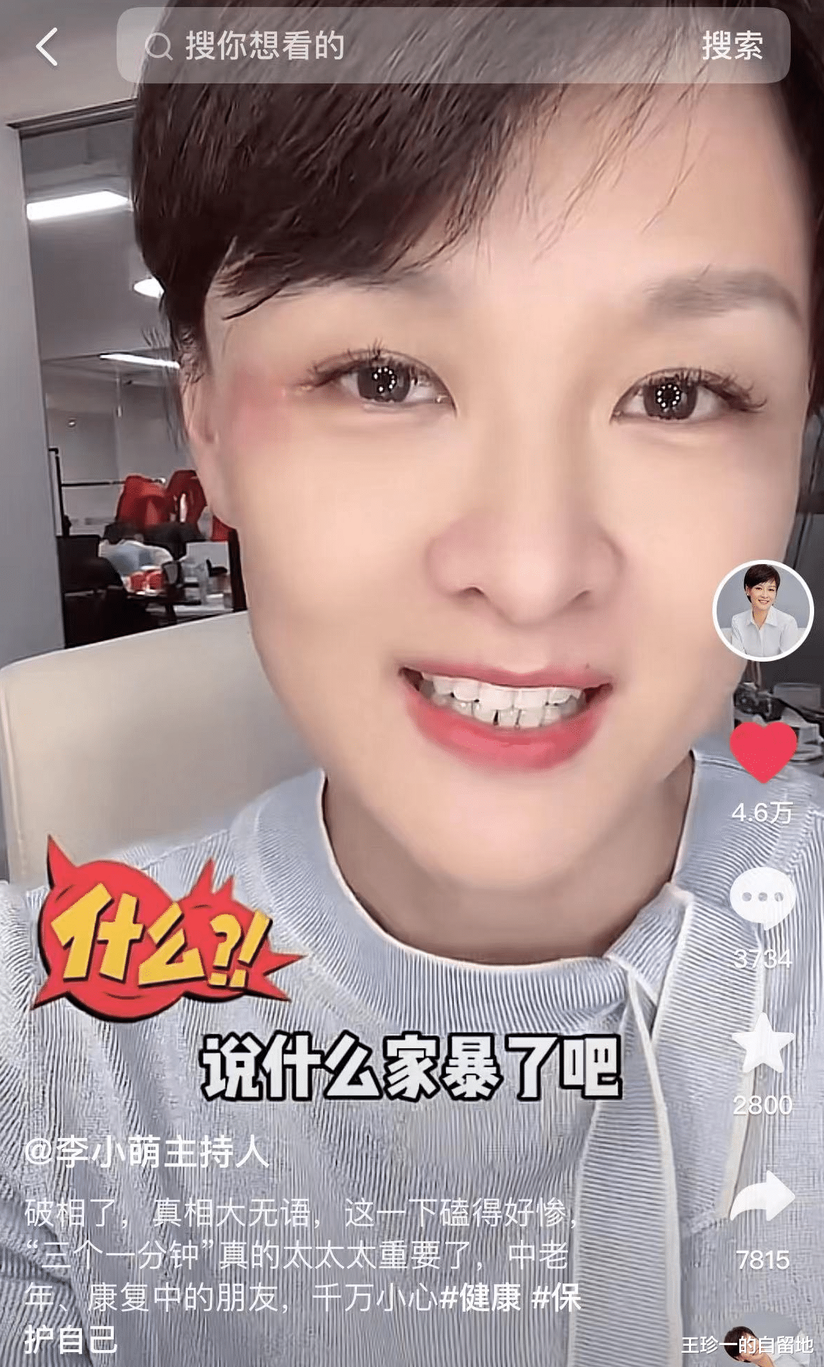 整容|3天7个瓜，曝赵本山将回归央视春晚，曝Z姓老艺术家出轨，都是大瓜