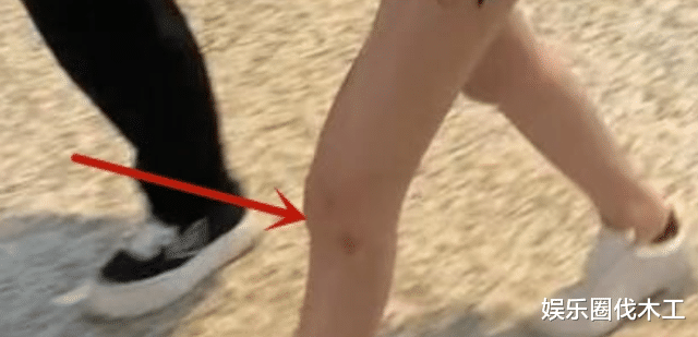 袁立|网曝李沁拍戏受伤，却遭嘲讽，网友：玻璃心