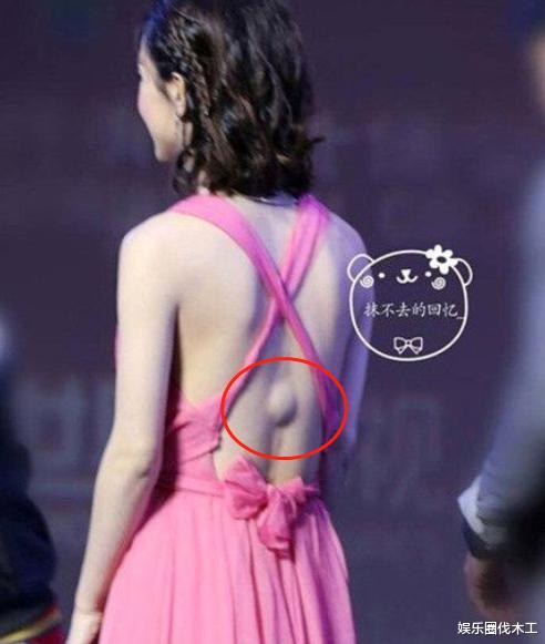 杨幂眼伤后首露面，左脸纱布包裹严实，走路靠人搀扶，将进组拍戏