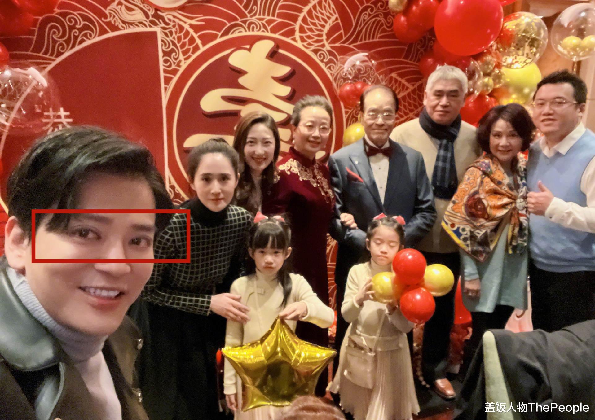 许佳琪|男星割双眼皮是分水岭？成龙周星驰提颜值，陈浩民眼皮能夹死苍蝇