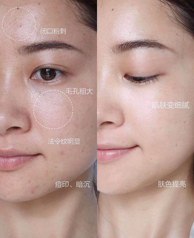 明星素颜 为什么有些人不化妆也好看?多做这“一步”,“素颜”也很美