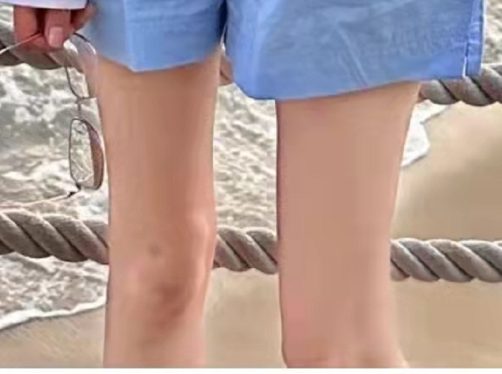 张颖颖|汪小菲被曝县城醉酒殴打张颖颖？女方浑身淤青伤痕，半夜报警求助