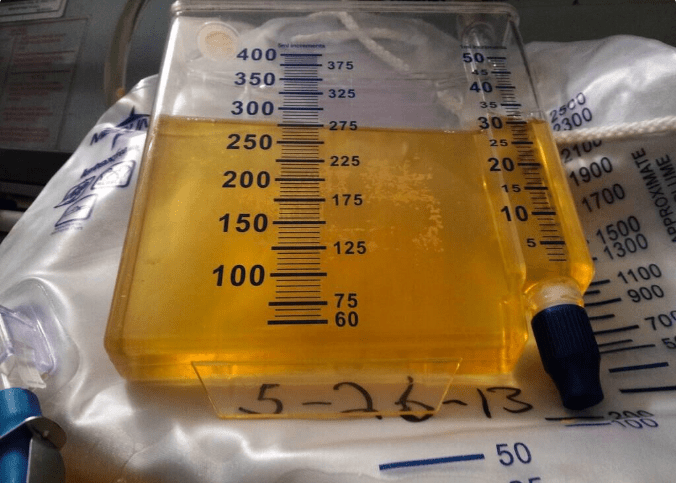 中成药|肌酐升高后想要避免尿毒症？把这一件事做好，肾病起码好一半