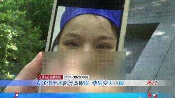 整形|女子做双眼皮修复结果变成大小眼，整形机构却称：是概率问题
