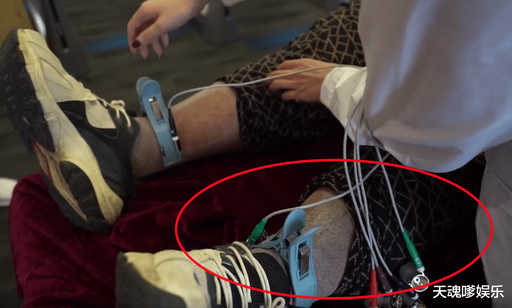 运动 600斤胖猴仔现身健身房，被4个大汉抬上床，腿青紫长出“鱼鳞斑”