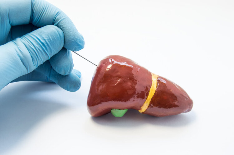 肝脏|为什么肝功能显示正常，却查出了肝癌晚期？肝功能检查值得做吗？