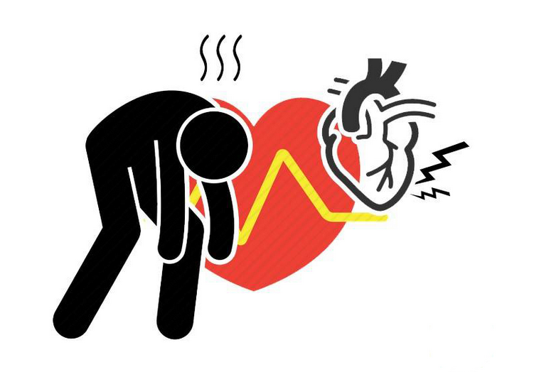 股骨头坏死|酿成心梗的根源：4种不良生活习惯！早点了解，早点戒掉