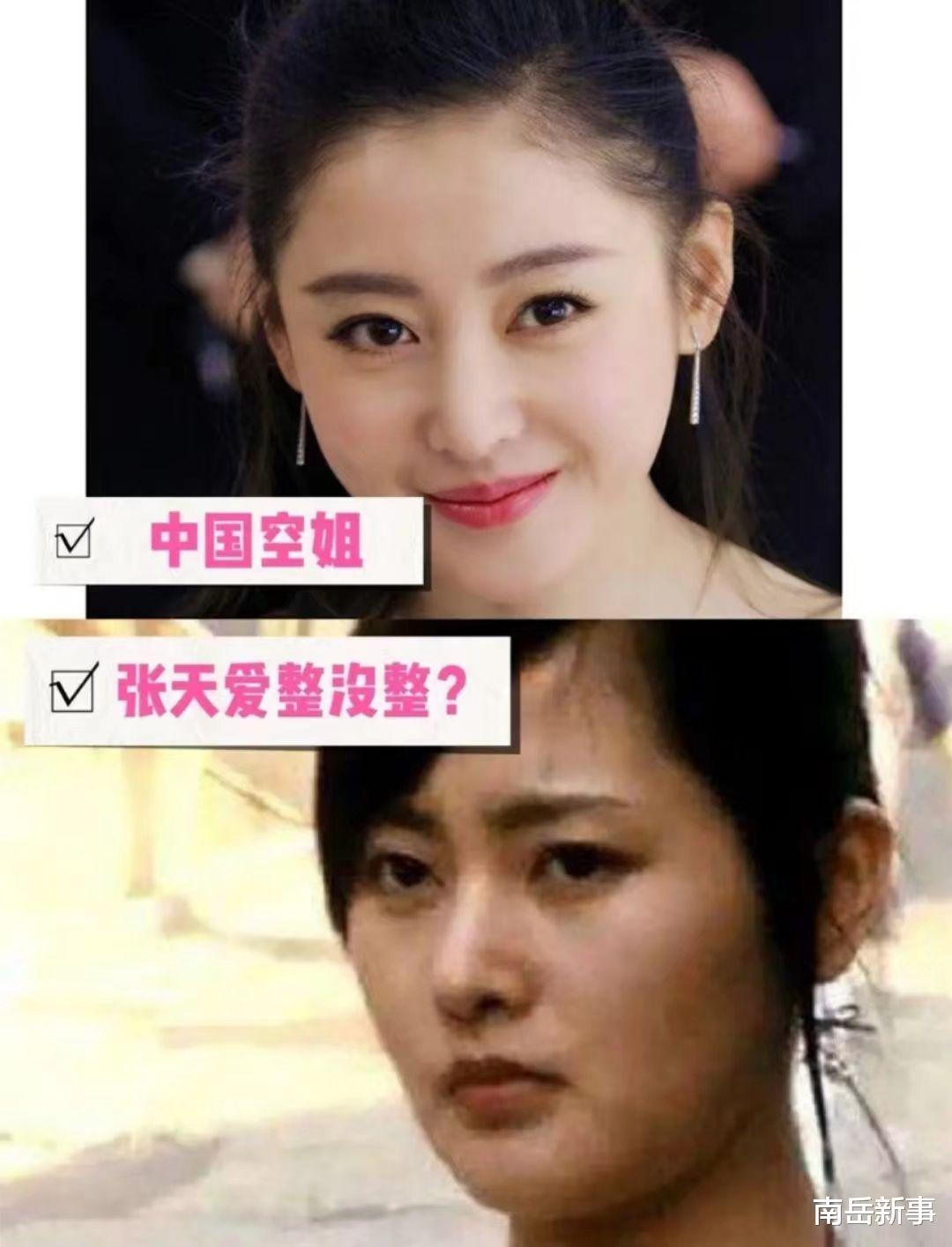 整容|整容、打针、过度减肥,9位浪姐为美太疯狂,面部僵硬认不出