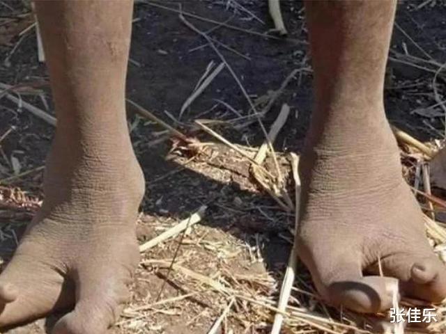 难道鸟族人真的存在，一群长着两个脚趾头的人，跟鸵鸟一样