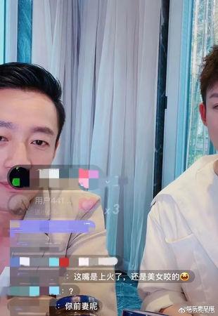 汪小菲|汪小菲受伤了!嘴唇惊见「红色伤口」网急问:是不是被美女咬