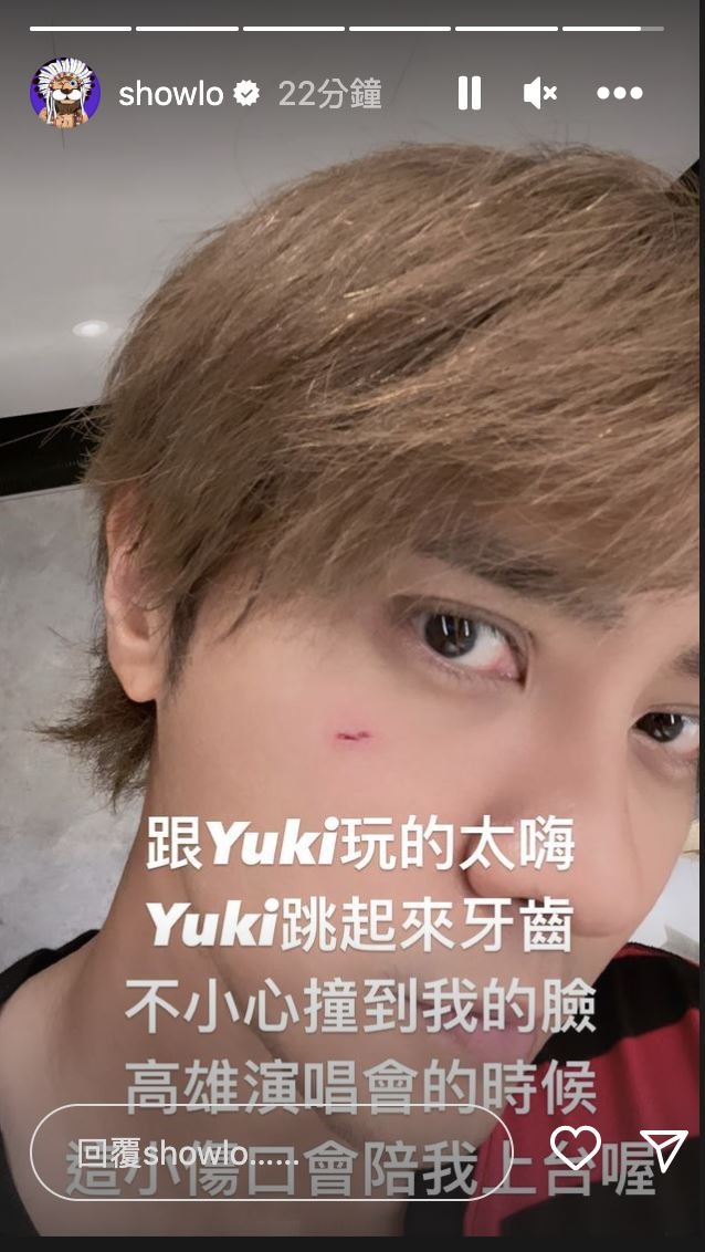 罗志祥|罗志祥脸部被自家狗狗撞伤,伤势照曝光,经纪人:正考虑是否就医