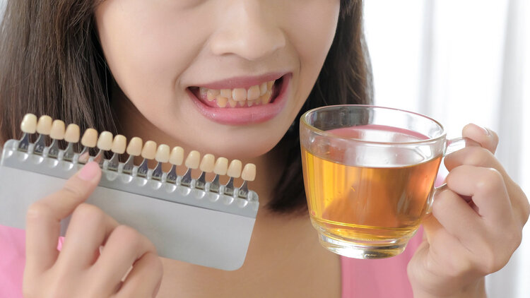 肾结石|男子喝茶喝出肾结石?长期喝白开水和长期喝茶,哪个对身体好