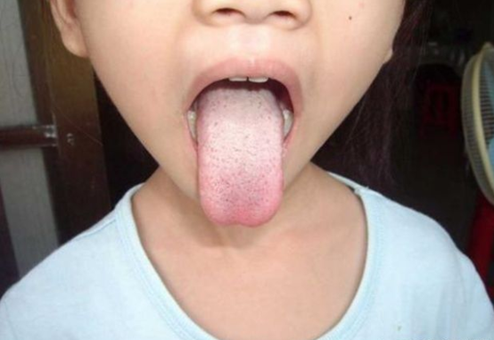 胃病|7岁男孩确诊脾胃衰弱,卫生组织呼吁:2种“粗粮”趁早撤下餐桌,别贪吃