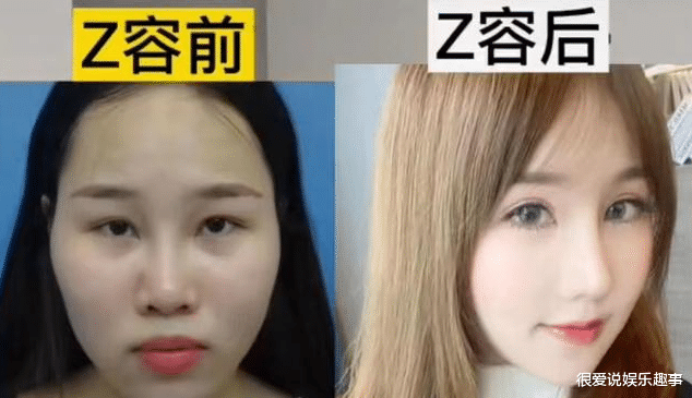 女孩整容被识破,亲戚要求退还100万彩礼:整容堪比换脸影响基因