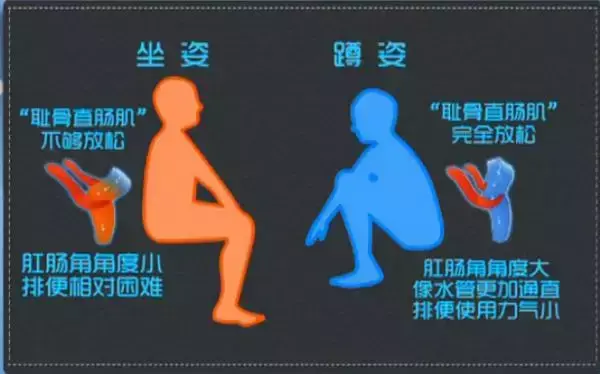 卫生间到底装蹲坑还是马桶好？对比完庆幸我家没选错！