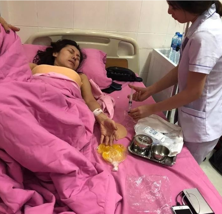 隆胸|越南女演员花1万元隆胸，结果坐飞机时胸炸了...