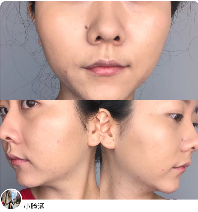 运动 均价100元的养肤粉底液合集！干皮最爱，滋润保湿不卡粉。