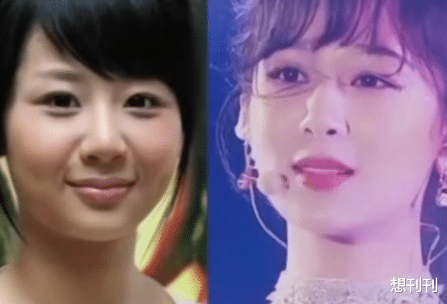 整容|出道了还去整容？换了张脸再出来，自封纯天然，他们当观众傻吗？