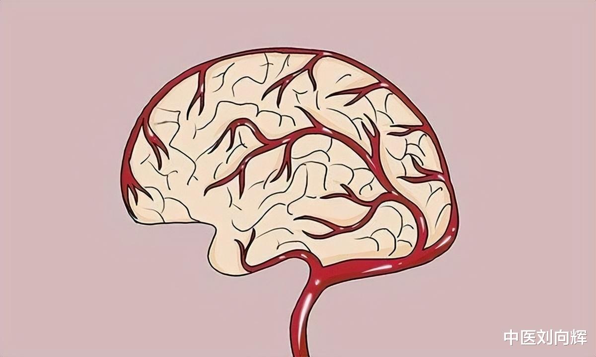 医生|想要10年不犯脑梗,医生教你一方,化痰逐瘀,未病先防