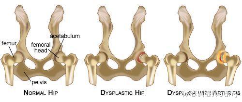 老年病|有一种\臀腿肥大\叫\假胯宽\，4个动作改善臀型，拥有好身材