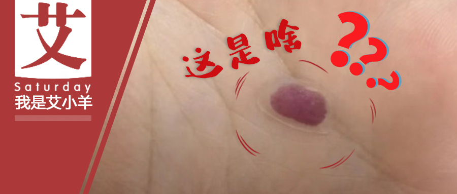 艾小羊：在老公身上发现的，谁能告诉我这是啥