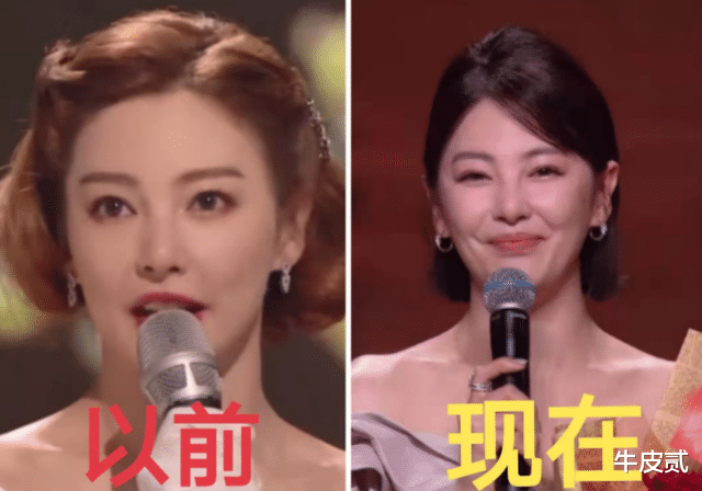 姐姐|明明“优雅自然”,却偏要“硅胶脸”的5大女星,个个苦不堪言