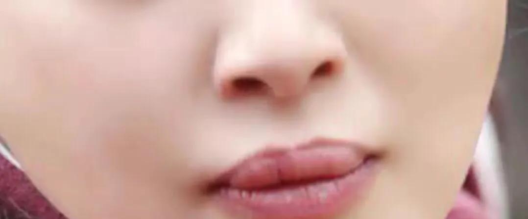 短发 Jessi厚唇被骂怪物、辛芷蕾三瓣唇、肯豆唇肿似蜂蛰,填充失败?