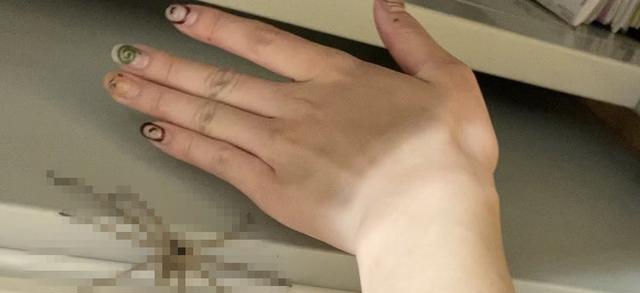 蚊子 妹子收集吸过自己血的蚊子，把血抽干做成“蚊子美甲”这画风？