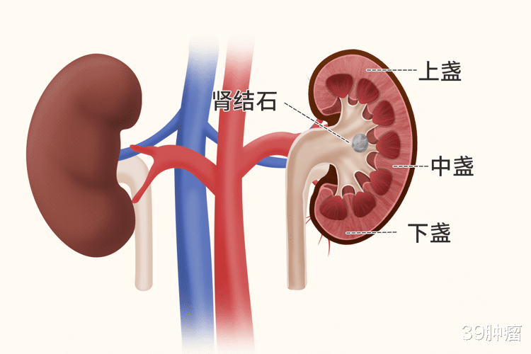 并发症|为什么“尿毒症”的人越来越多?6个习惯别碰,肾感谢你一辈子