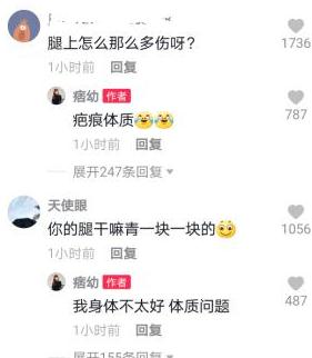 |“痞幼”到朋友家做客,胳膊淤青被质疑遭家暴,本尊回应尽显无奈