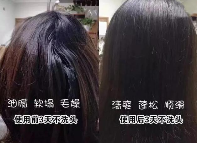 洗发水 国内一“委屈”洗发水，因价低“被轻”，用后头油头屑渐渐改善！