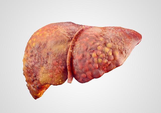 肝脏|肝脏开始变硬前,身体会亮起6盏“红灯”,别再装作看不见了!