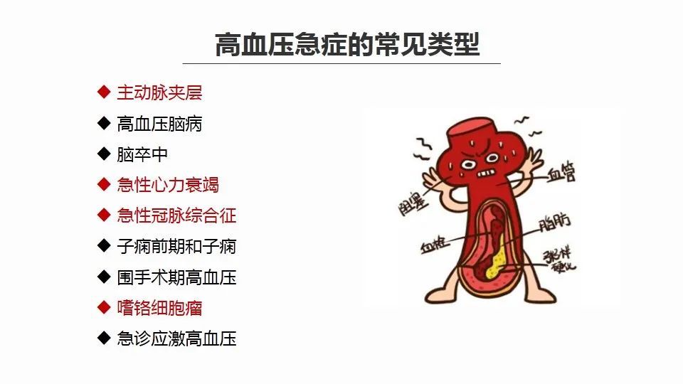 高血压|不同类型高血压急症,首选该用什么药?看完这篇就清晰了