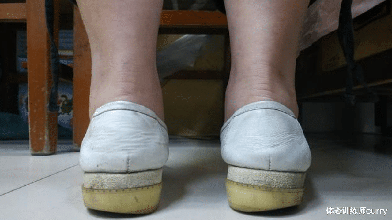 疾病|身体好不好,看鞋就知道?骨科大夫:鞋底穿成5个模样,该留意了