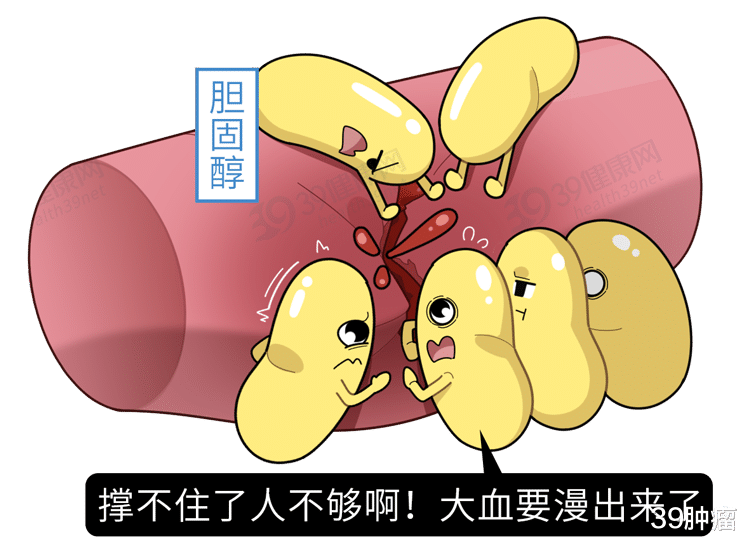 疫苗|上海瑞金研究：“坏胆固醇”越低，癌症风险越高？如何平衡血脂？