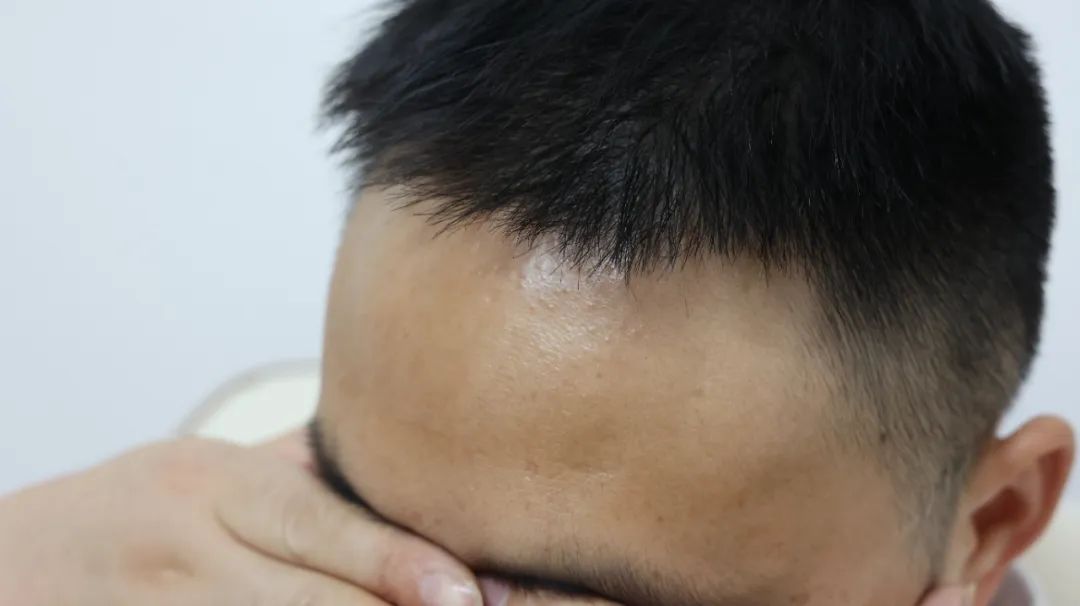 肾虚|男人的肾功能下降,3个部位会“汗如雨下”,别不自知