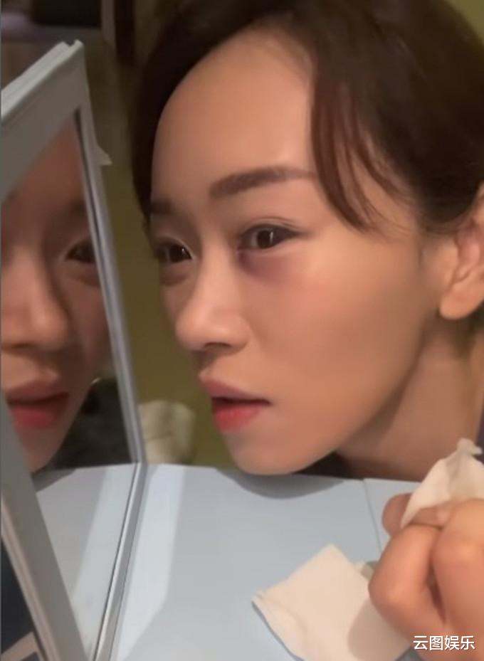 杨思琦|44岁港姐内地拍戏险变瞎子!被对手撞伤眼部,淤青红肿痛到流泪