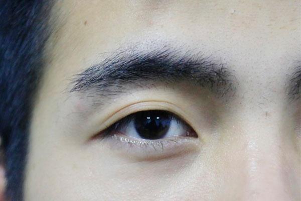 黑眼圈|男性养肾要趁早,脸上出现三种症状时,可能是肾脏发出的求救信号